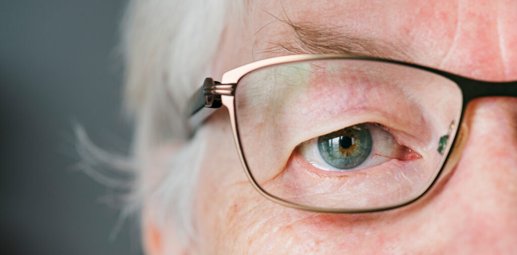 Glaucoma Treatment in Omaha, NE