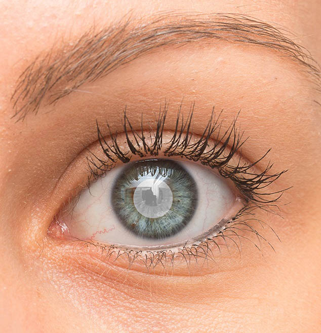 Omaha cataract management